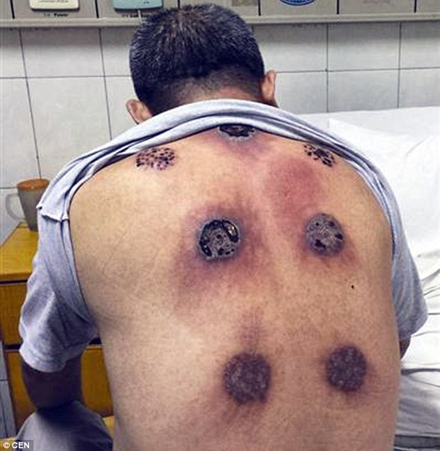 3593C4C200000578-3655854-Doctors_say_that_he_was_lucky_he_went_to_the_hospital_when_he_di-m-3_1466672313716